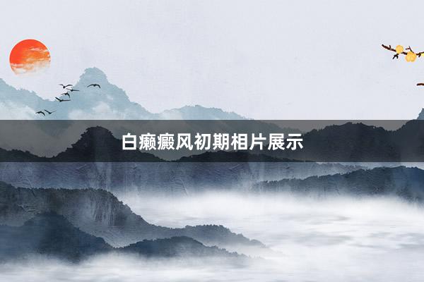 白癞癜风初期相片展示